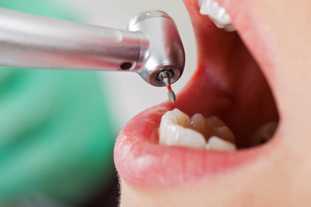 Best Emergency Dental Extractions in Christiana, TN